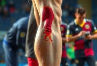 格纳布里右大腿内收肌撕裂无缘世界杯，德国队这次真有点悬了